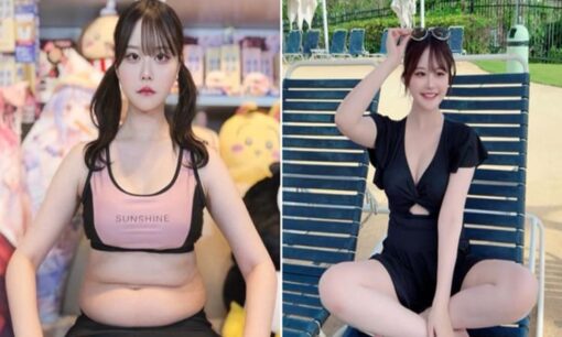 整形アイドル轟ちゃんの着痩せビフォーアフター投稿が爆発的な大反響 総額1350万円整形の過去といじめ克服の軌跡、女性から絶大な支持